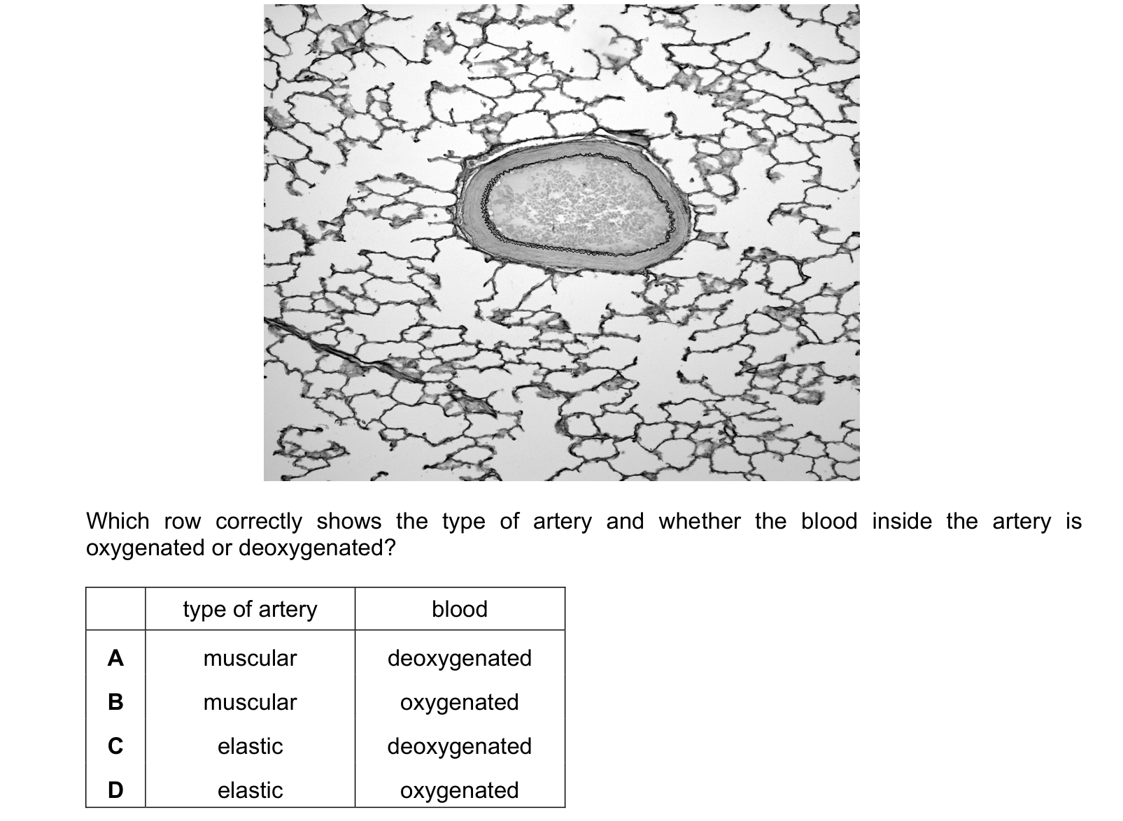 Diagram from the Cambridge Biology 9700 Paper 1 February/March 2023 paper, variant 2, question 31.