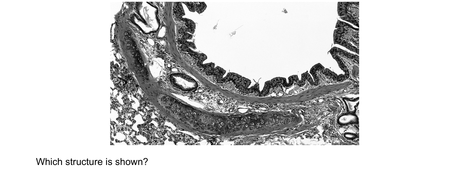 Diagram from the Cambridge Biology 9700 Paper 1 October/November 2023 paper, variant 3, question 34.